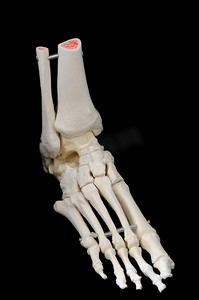 脚骨架的右侧前部