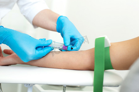 戴手套的护士将针头插入患者手臂上的静脉，并将血液抽入真空容器中。
