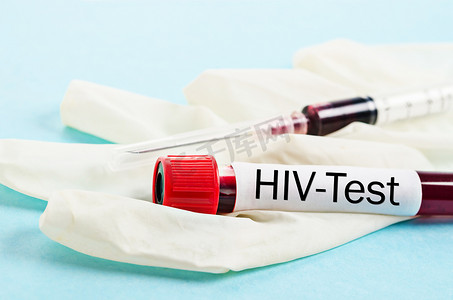 艾滋病毒筛查试验。