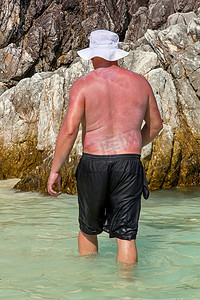 燃烧的人涂上了防晒霜背景的岩石。