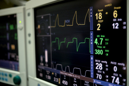 医院手术室的心脏监测器和静脉滴注