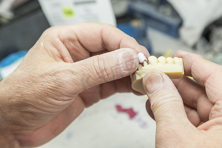 牙科技师正在研究牙种植体的 3D 打印模具