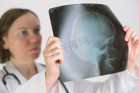 医生分析人类头骨 x 射线筛查图像