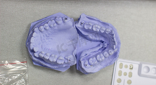 儿童正畸口腔内照摄影照片_在正畸医生处用石膏制成的牙齿石膏模型。