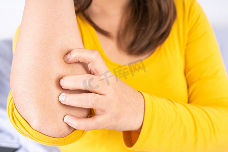 疼痛广告摄影照片_女性用复制空间在白色背景上抓她的手臂。