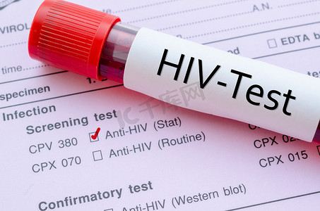 筛查摄影照片_HIV 感染筛查测试表。