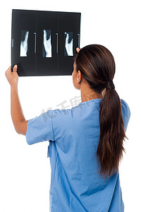 患者教育摄影照片_看患者的 X 光报告的女医生