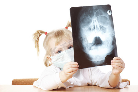 孩子在玩 X 光照片