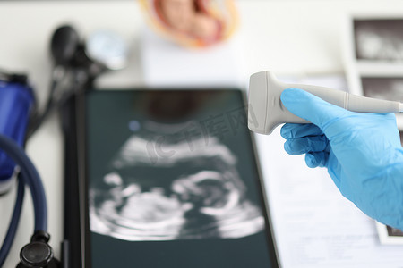 胎儿在​​子宫内的超声图片和医生经颅多普勒造影