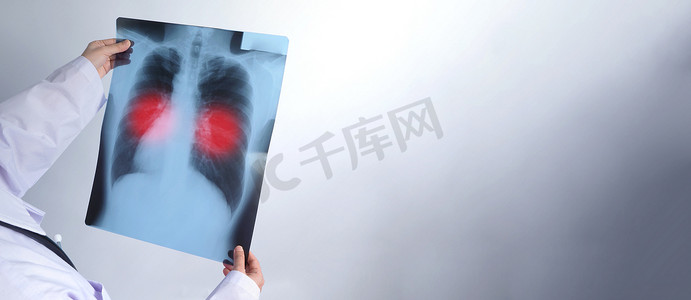 中年亚洲女医生站着拿着 X 光片