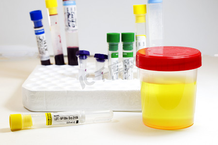 白色背景上用血液和其他管进行药物测试、医用尿液和尿液测试、彩色实验室测试容器