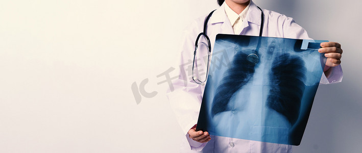 中年亚洲女医生站着拿着 X 光片