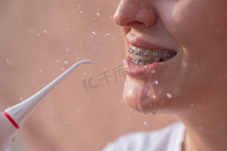 一位戴牙套的女士使用冲洗器。