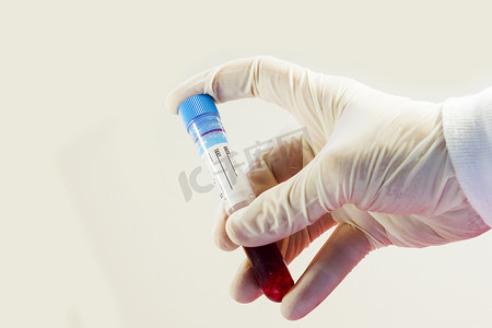 带白色手套摄影照片_带手套的医生手中的血液测试全管，在白色背景下，工作室拍摄。