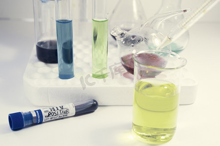 HIV测试血管和实验室玻璃、仪器和病毒研究