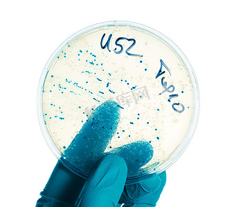 戴着丁腈手套的手拿着带有细菌菌落的培养皿