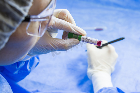 艾滋病毒和艾滋病感染检测，医生的脸和手拿着蓝色背景上带血的管子。