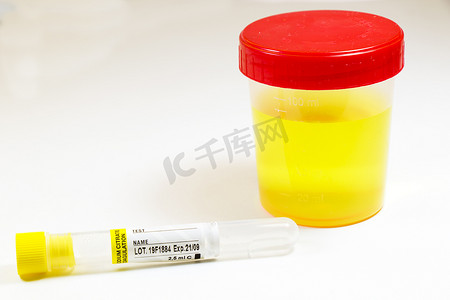 彩色吸管杯摄影照片_白色背景上用血液和其他管进行药物测试、医用尿液和尿液测试、彩色实验室测试容器