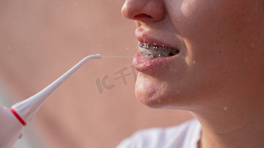 戴牙套摄影照片_一位戴牙套的女士使用冲洗器。