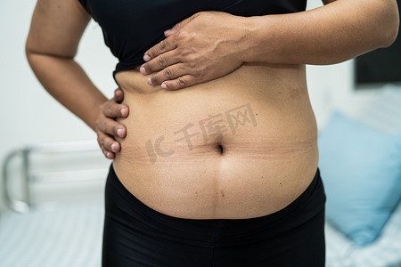 肥胖女性摄影照片_超重的亚洲女性在办公室表现出肥胖的腹部。