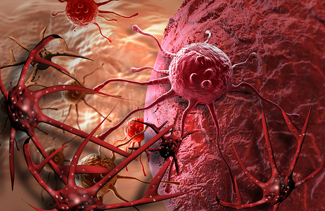 血液肿瘤摄影照片_癌细胞