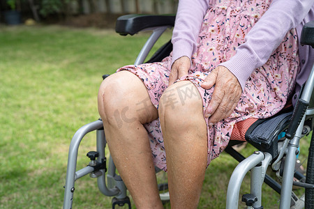 亚洲老年或老年老太太妇女病人在护理医院病房的床上展示她的疤痕手术全膝关节置换缝合伤口手术关节成形术，健康强大的医疗理念。
