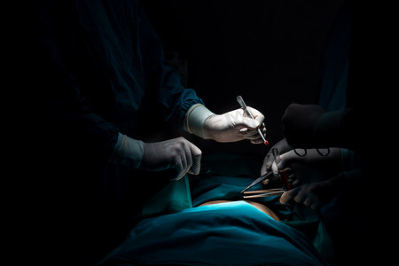 手术团队摄影照片_特写手术团队在无菌手术室对患者进行手术。