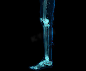 3d脚摄影照片_在黑色背景上隔离的下肢或腿的 3D 渲染。