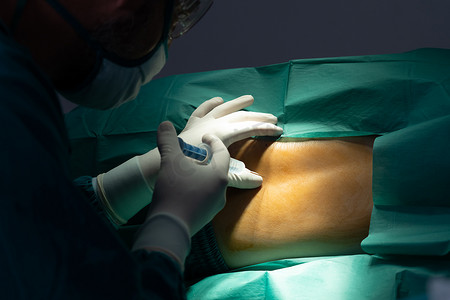 外科医生在手术前用无菌注射器给病人注射麻醉剂。