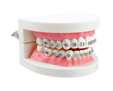 坤3d模型摄影照片_带有金属丝牙套或白色背景上隔离的牙科器械的牙齿模型，保存剪切路径。