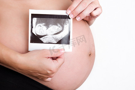 超音波摄影照片_孕妇持有超声扫描隔离在白色背景