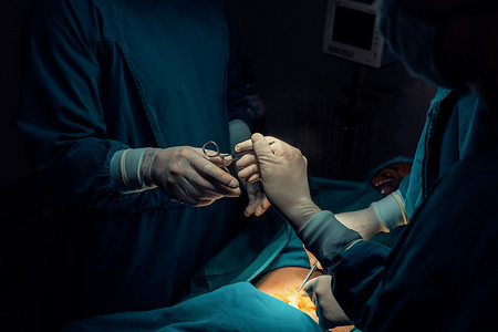 手术团队摄影照片_手术团队执行手术的图像护士分发无菌剪刀。