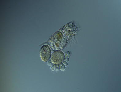 轮虫在显微镜下水中游动