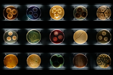 培养皿中不同类型的细菌、霉菌和真菌