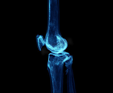 在显示疼痛区域的黑色背景上隔离的膝关节的 3d 渲染。
