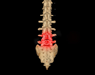 显示人体脊柱轮廓的腰椎 3D 渲染 CT 扫描。