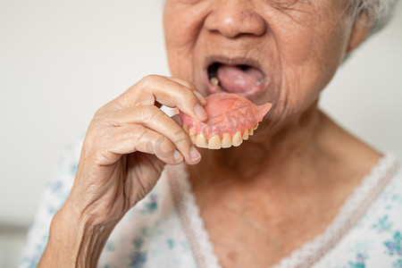 亚洲老年妇女患者坚持使用假牙，健康强大的医疗理念。