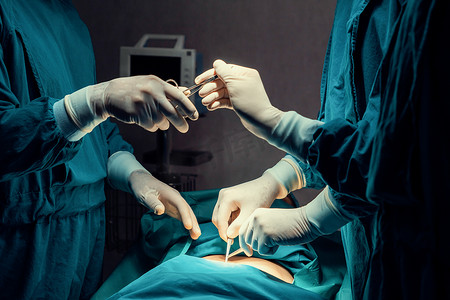 手术团队执行手术的图像护士分发无菌剪刀。