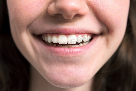 笑容牙齿摄影照片_关闭年轻女子美丽的笑容与洁白健康的牙齿