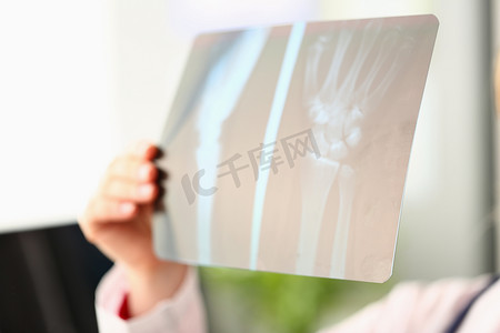 医生手里拿着手臂的 X 光片