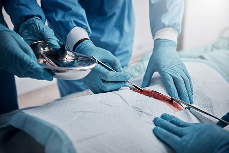 医生、护士或外科手术在医院急诊室为胃溃疡、心脏病发作或阑尾爆裂的病人提供服务。