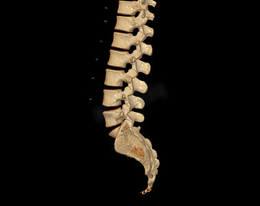 人体腰椎摄影照片_显示人体脊柱轮廓的腰椎 3D 渲染 CT 扫描。