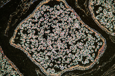 种子防伪追溯摄影照片_带种子的俱乐部苔藓花在显微镜下 100 倍