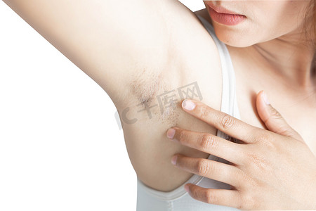 51脱毛摄影照片_女性在白色背景下出现黑色腋窝问题，用于皮肤护理和