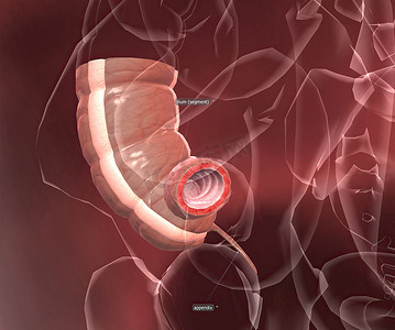 阑尾炎是指阑尾的炎症，指状囊从腹部右下侧的结肠突出。