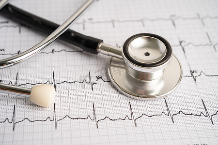 心电图仪摄影照片_听诊器心电图心电图、心电波、心脏病发作、心电图报告。