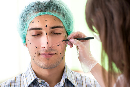 眼睛手术摄影照片_整形外科医生准备在人脸上进行手术