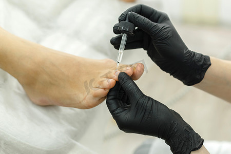 修脚师在指甲上涂上软化油或吸管中的医药产品