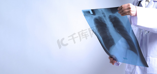 亚洲女医生手持检查肺部 X 光片