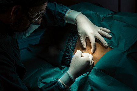 麻醉剂摄影照片_外科医生在手术前用无菌注射器给病人注射麻醉剂。